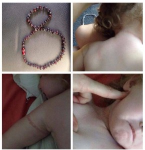 amber teething necklace warning sids