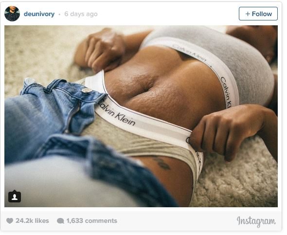 Mother puts her pregnancy scars on display to mirror Kendall Jenner's Calvin  Klein ad