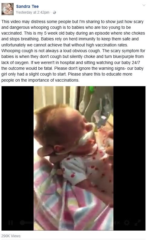 baby with whooping cough